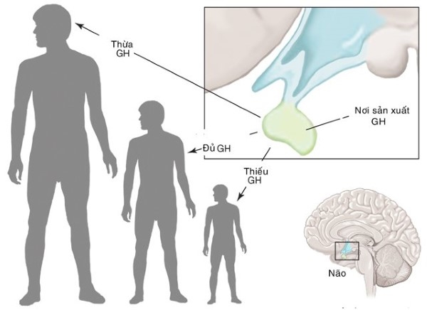 Hormone tăng trưởng (GH) sẽ kích thích sự phát triển của xương và mô mềm