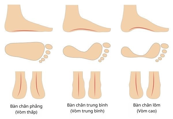 Cách chọn giày cho những người có bàn chân đặc biệt