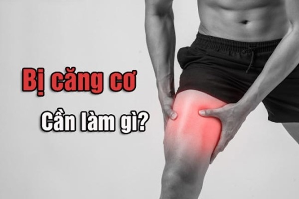 Nên làm gì khi bị căng cơ?